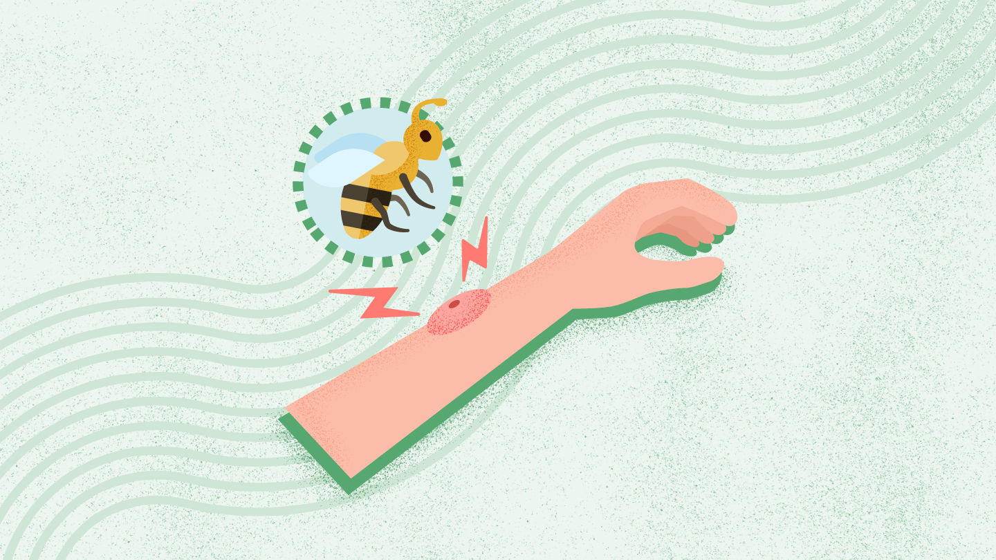 Neurotoxins-Stings/Bites