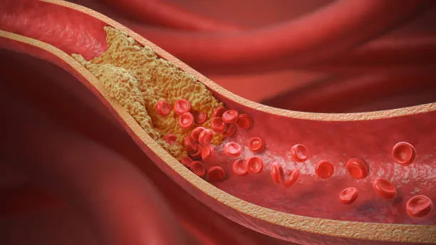 Reverse Cholesterol Transport Process