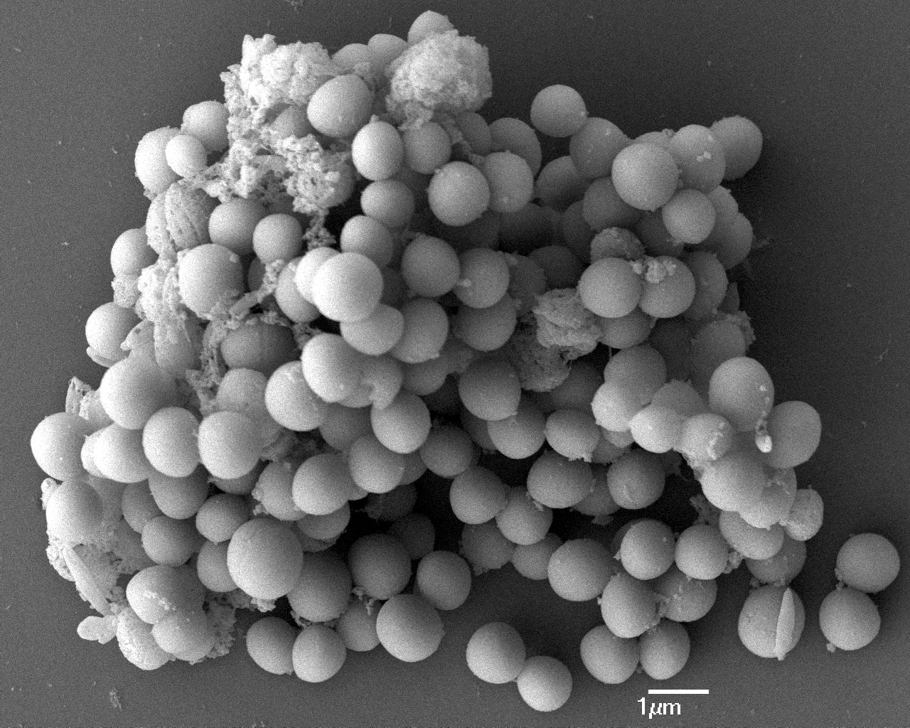 Staphylococcal Infections – harmonyvials