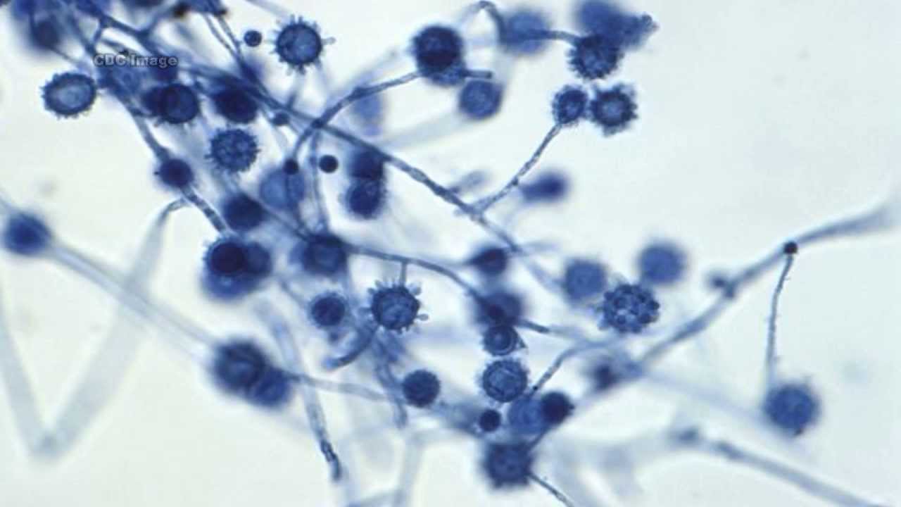 Pathogenic Fungi – harmonyvials